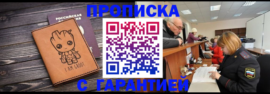 временная регистрация собственник в Череповце